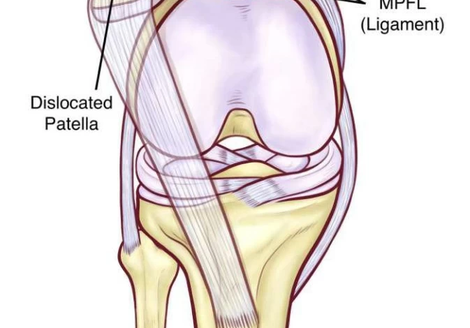 تفاصيل إصابة حمد اليامي لاعب الهلال ومستقبل موسمه