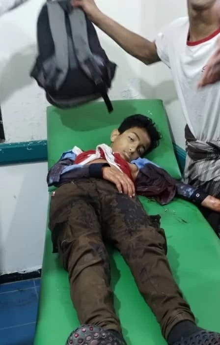 قناص حوثي يقتل طفلاً في تعز: جريمة حرب مروعة باليمن